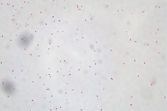 Akkermansia Muciniphila AKK016 AKK 白から白灰まで 粉末/ プロバイオティクス